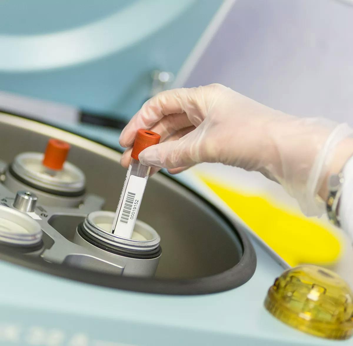 Lab procedure after the surgical sperm retrieval