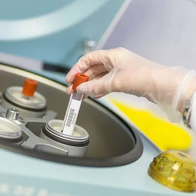 Lab procedure after the surgical sperm retrieval