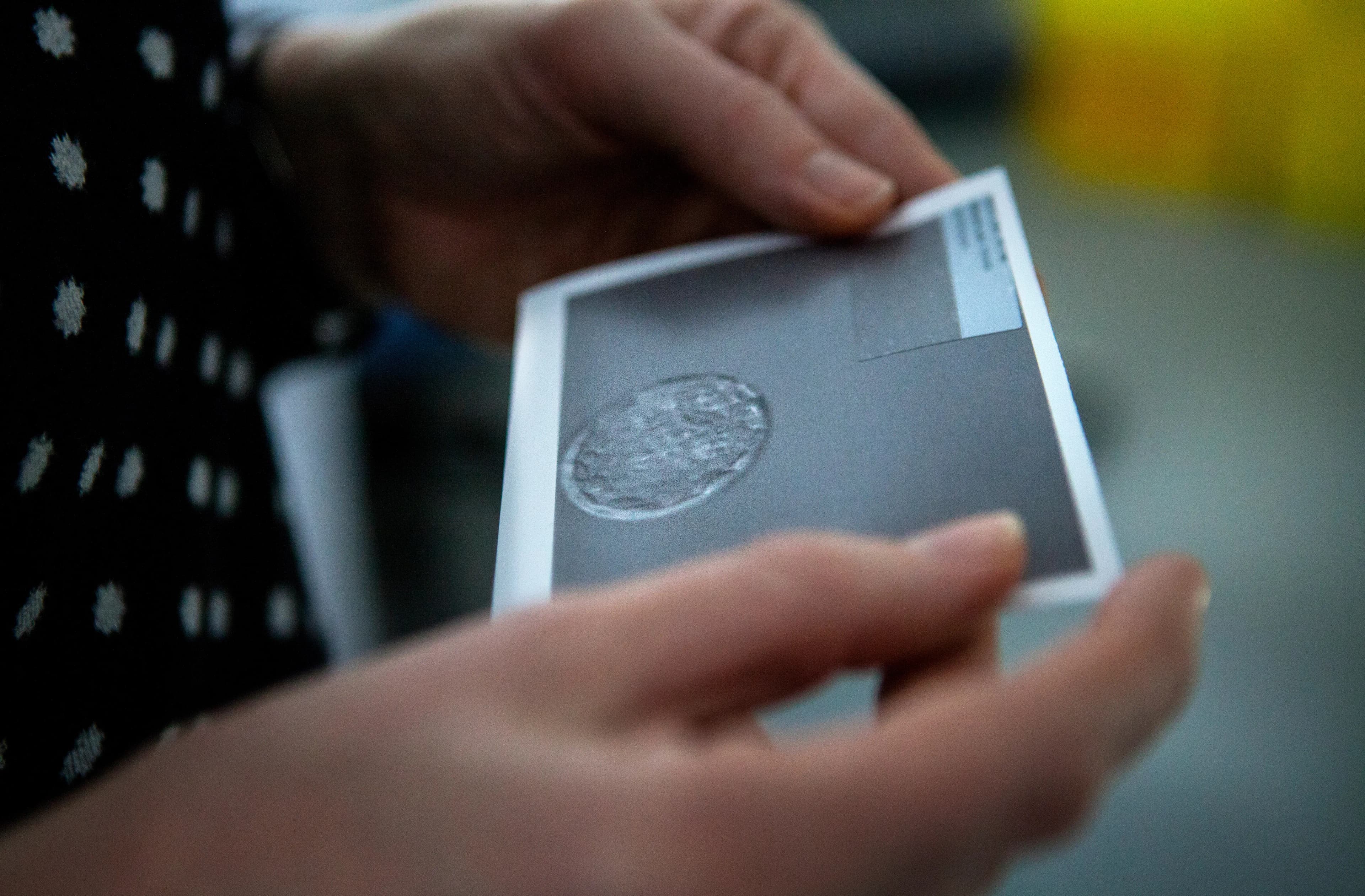 embryo