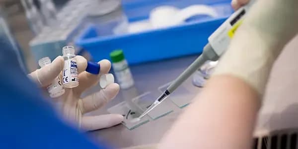 Sperm motility