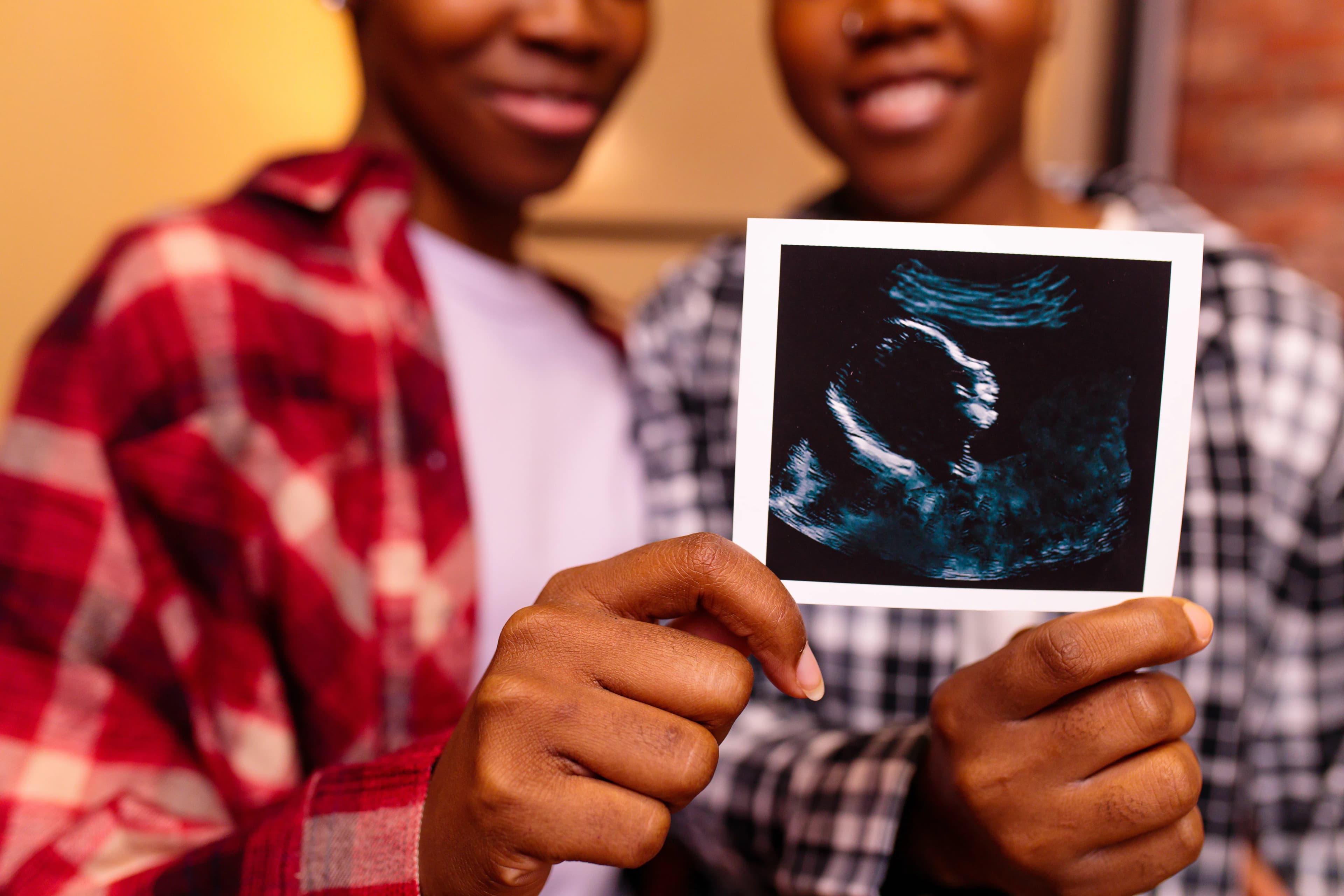 A same-sex female couple holding an ultrasound of a baby